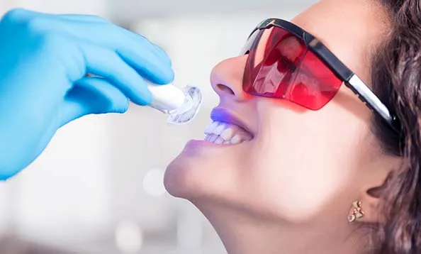 Woman undergoing teeth whitening