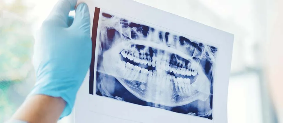 Examining dental x-ray